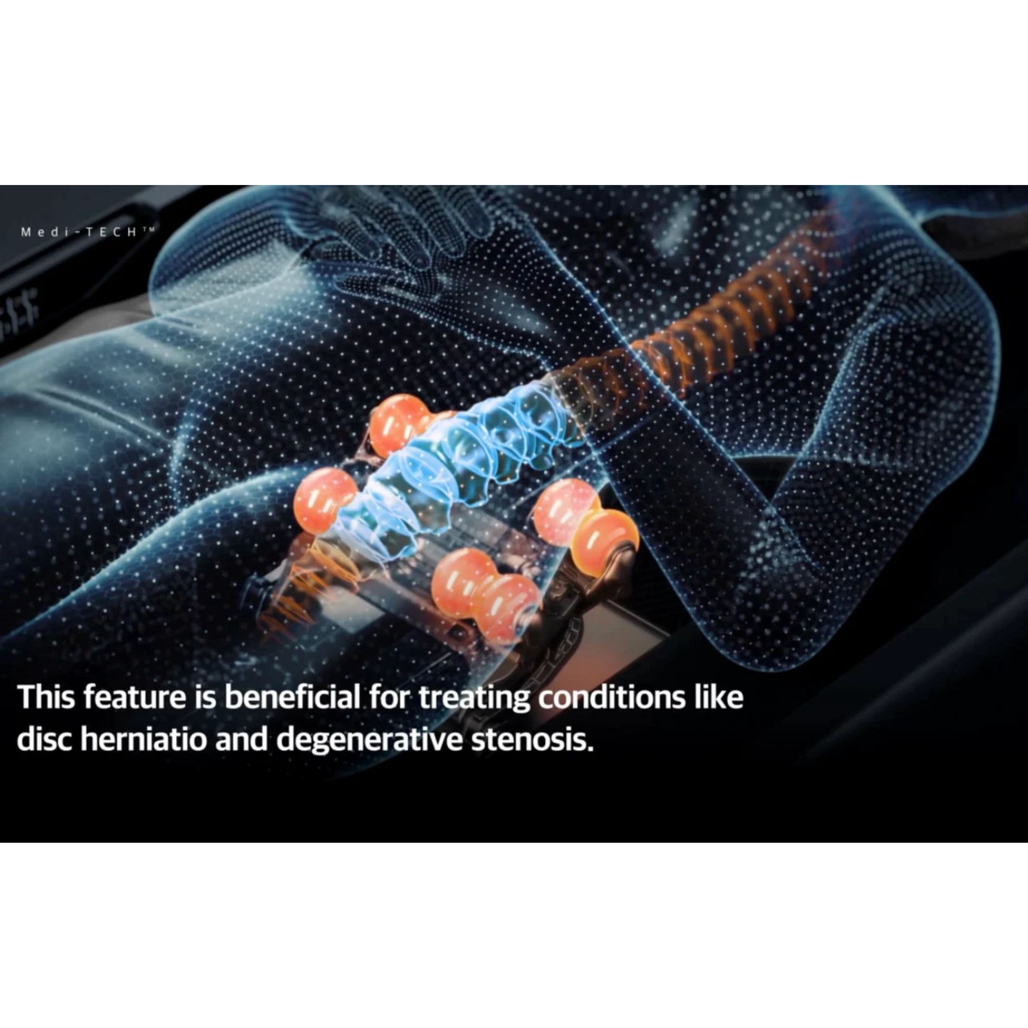 Ceragem V7 Massage Bed Treating Conditions Such As Herniation And Degenerative